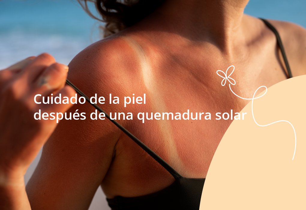Cuidado de la piel después de una quemadura solar: recuperación sana